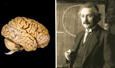 cerebro de Einstein